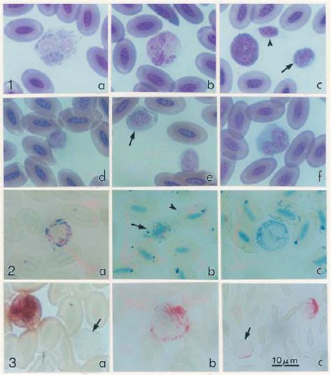 Figure Figure Wrights Giemsa Cytochemical Stain Stained Of Blood