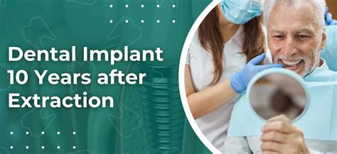 Dental Implant 5 Years After Extraction At Angela Bates Blog