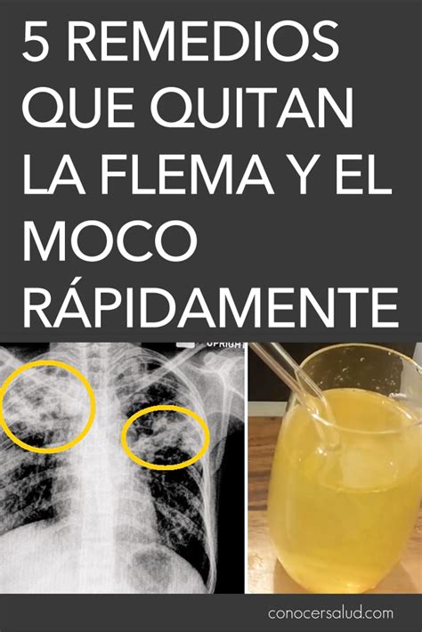 Remedios Que Quitan La Flema Y El Moco R Pidamente