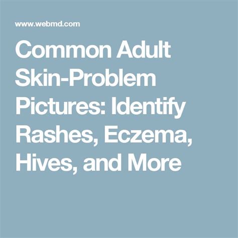 Identifying Skin Rashes In Adults