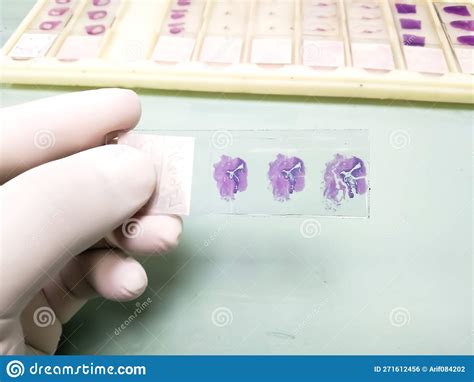 Histology Hematoxylin And Eosin He Stained Glass Slide Stock Photo