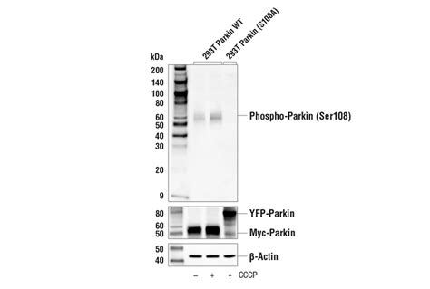 Phospho Pink1 Ser228 Antibody Cell Signaling Technology