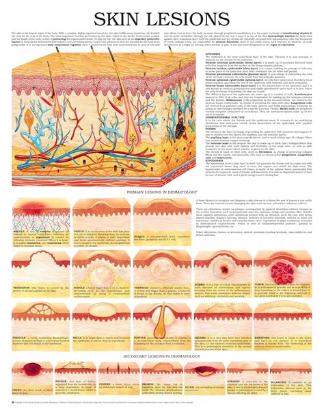 Skin lesions e chart: Full illustrated eBook : HC-HealthComm: Amazon.in ...