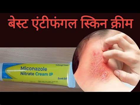 Miconazole Antifungal Cream Micogel Antifungal Cream Miconazole