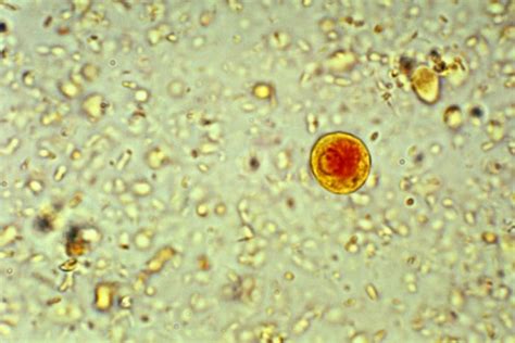 What is an amoeba? | Live Science