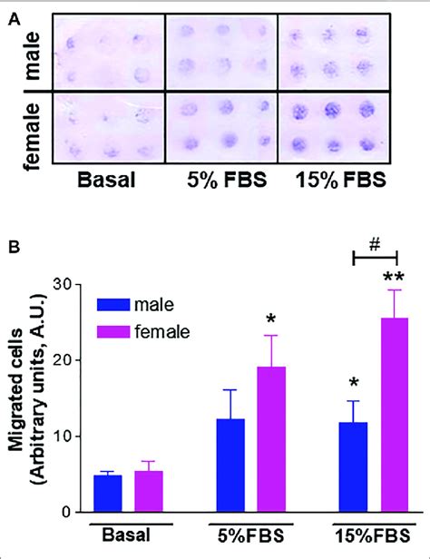 Effect Of Donor S Sex On Huvec Migration In A Chemotaxis Assay Using Download Scientific