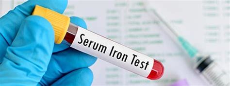 Serum Iron Test Procedure Results And Normal Ranges 44 OFF