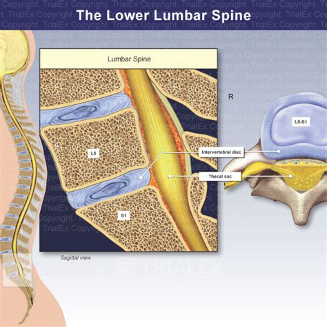 What Is A Thecal Sac Compression At Cruz Nolen Blog