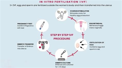 Test Tube Baby Process Diagram