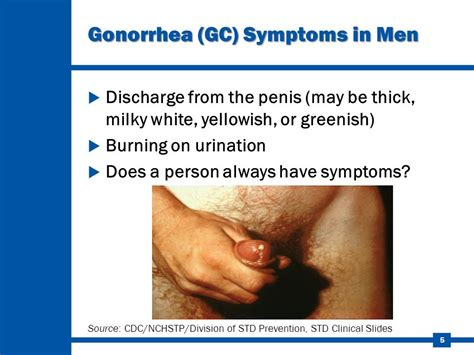 Chlamydia Std In Men