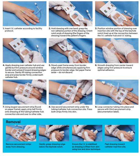 Hemostatic Dressing Application at Annie Anderson blog