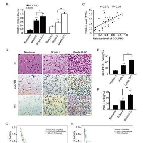 Up Regulation And Positive Clinical Relevance Of GOLPH3 And Wls In