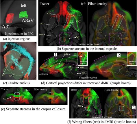 The Brain Minds Marmoset Connectivity Atlas Exploring Bidirectional Tracing And Tractography In