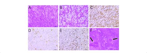 Histopathological Findings He Staining A ×40 B ×200 Show Download Scientific Diagram