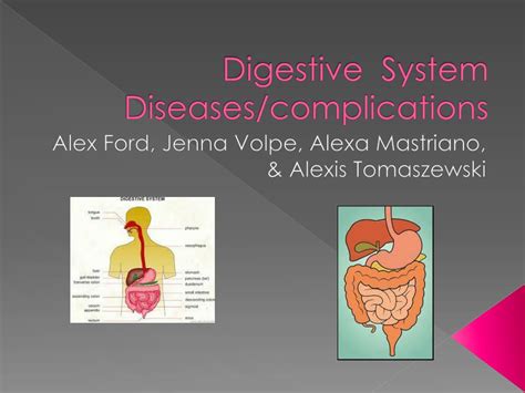 Ppt Digestive System Diseases Complications Powerpoint Presentation