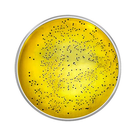 Salmonella Shigella Agar, Modified (SS Agar), 90mm Plate, 41% OFF