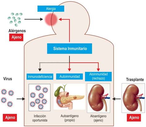 Patolog A General Del Sistema Inmunitario Paradigmia