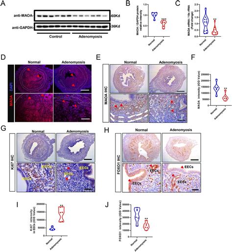 Maoa Decreased In The Eecs Of The Adenomyosis Mice Model A And B