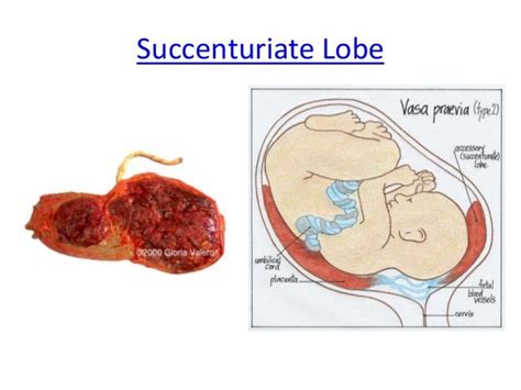 The Placenta Odds And Sods