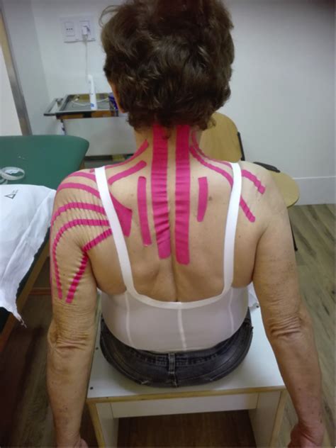 Utilizzo Del Taping Neuromuscolare Kinesiotape Come Supporto Alla