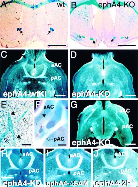 Kinase Dependent And Kinase Independent Functions Of Epha Receptors In