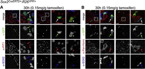 Sox2 Stem Progenitor Cells In The Adult Mouse Pituitary Support Organ