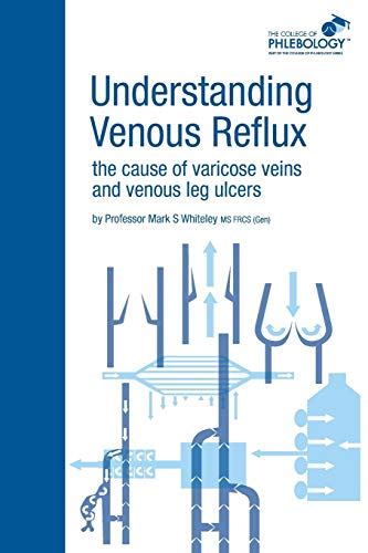 Understanding Venous Reflux The Cause Of Varicose Veins And Venous Leg