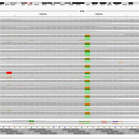 Figure S7 Integrative Genomics Viewer IGV Snapshot Of C 124C T TERT