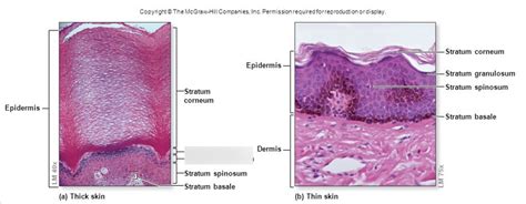 Label The Photomicrograph Of Thick Skin Quizlet Epidermis Of Thick Skin Diagram Quizlet