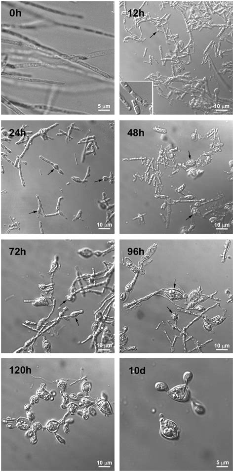 Time Lapsed Transformation Of P Brasiliensis Hyphae To Yeast Forms