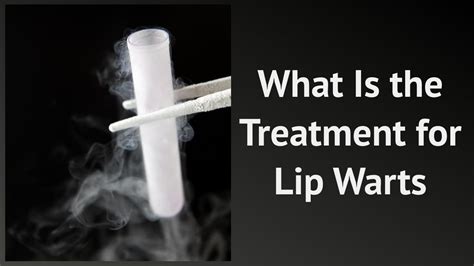 What Is The Treatment For Lip Warts Youtube