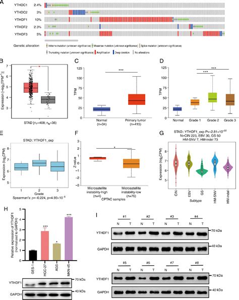 Figure 1 From Ythdf1 Regulates Immune Cell Infiltration In Gastric Cancer Via Interaction With