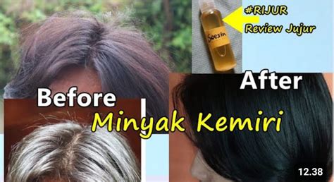 Uban Auto Minggat Yuk Simak Manfaat Minyak Kemiri Untuk Rambut