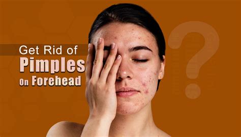 How to Get Rid of Bumps on Forehead - Health For Best Life