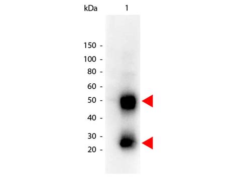 verbrühen Vorgänger Besatzung mouse igg kappa binding protein Ort ...