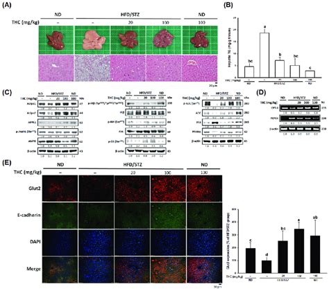 Amelioration Of Hepatic Steatosis And By Thc In Hfdstz Treated Mice