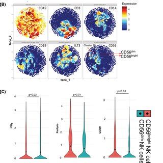 Bladder Tumorinfiltrating CD56bright NK Cells Expressed A