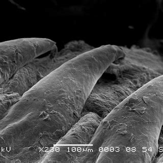 Scanning Electron Microscope SEM Photomicrograph Of Papillae Within