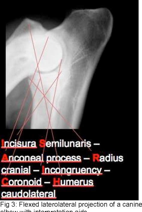 Figure 3 From Diagnosing Elbow Dysplasia And Current Treatment Options Semantic Scholar