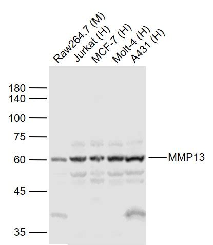 Sample Mg Human Cell Lysate At Ugprimary Anti Mmp Bs R