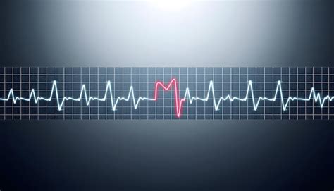 Electrocardiogram Ecg Heart Wave Heart Attack Cardiogram Report