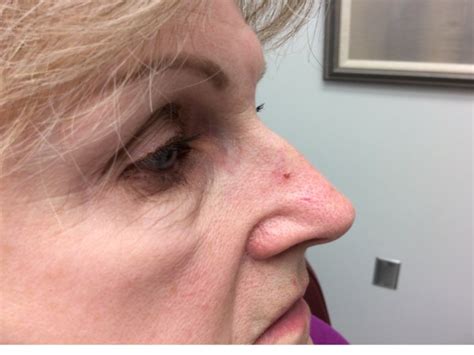 Can You Spot Skin Cancer Keep An Eye Out For These Warning Signs