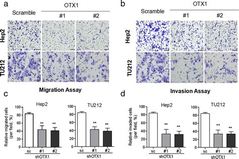 Knockdown Otx Expression Attenuates Lscc Migration And Invasion In