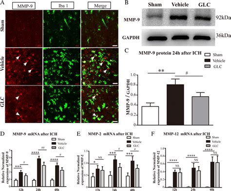 The Regulation Effect Of Glibenclamide On Mmp And Mmp Mrna Levels After