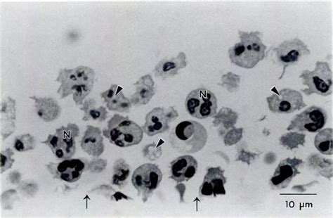 Light Micrograph Of A Cross Section Of High Density Neutrophibs N