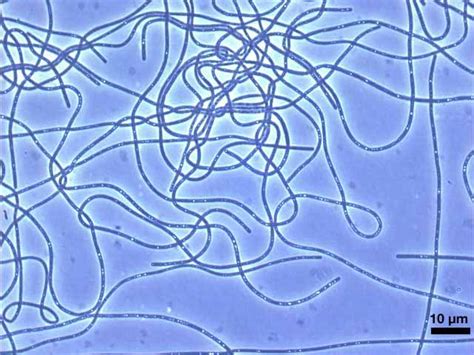 The Phylum Chloroflexi Is A Deep Branching Lineage Within The Domain