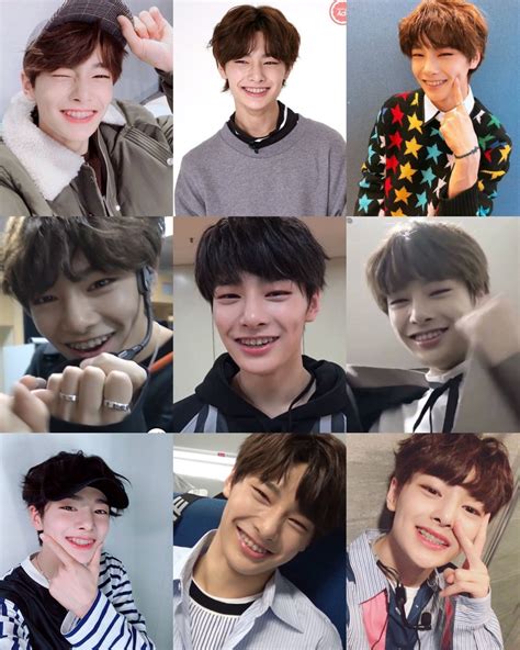 Head Jeonginer On Twitter Jeongin With Braces Is The Cutest Thing Ever