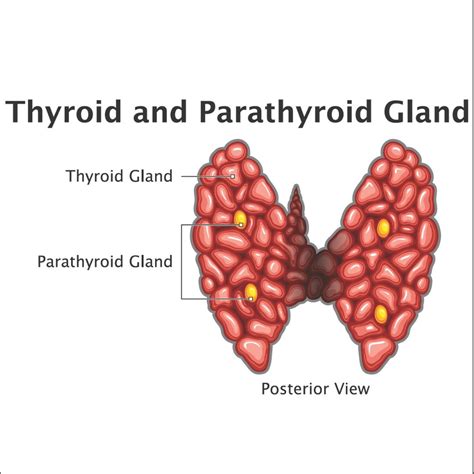 Parathyroid Cancer Causes Risk Factors Symptoms Treatment