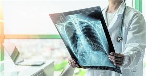 Ai Model Using Chest X Rays To Accurately Estimate A Persons Age And