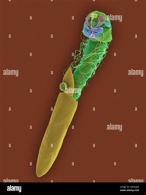 Coloured Scanning Electron Micrograph Sem Of Hatching Egg Of A